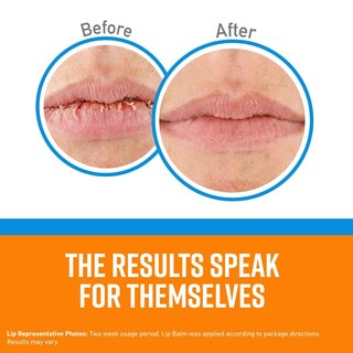 Foto 5 | Foto 5 | Lápiz De Reparación De Labios O'keeffe's Refrigerante 6 Unidades