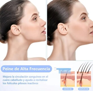 Foto 3 | Foto 3 | Dispositivo Facial De Alta Frecuencia 4 Electrodos Ajustable Modelo Blanco