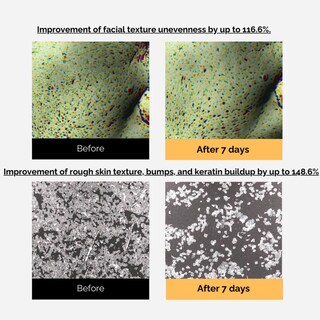 Foto 4 | Foto 4 | Crema Facial Mommy Care Yulmu Cream 50ml – Nutritiva Y Calmante Con Extractos Naturales Para Piel Sensible Y Textura Mejorada