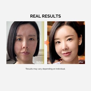 Foto 5 | Foto 5 | Crema Facial Mommy Care Yulmu Cream 50ml – Nutritiva Y Calmante Con Extractos Naturales Para Piel Sensible Y Textura Mejorada