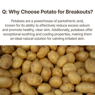 Foto 6 | Foto 6 | Mascarilla Facial Mommy Care Potato Wash Off Pack 100g – Tratamiento Suave Para Poros Dilatados Y Piel Clara