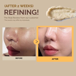 Foto 8 | Foto 8 | Mascarilla Facial Mommy Care Potato Wash Off Pack 100g – Tratamiento Suave Para Poros Dilatados Y Piel Clara