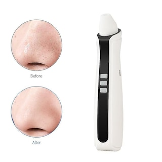 Foto 1 | Foto 1 | Limpiador Facial Removedor De Puntos Negros Huoguo Recargable Usb - Venta Internacional.