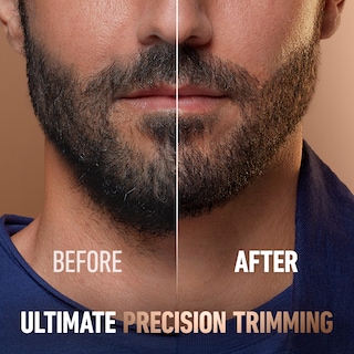 Foto 4 | Foto 4 | Recortadora Gillette King C. Pro 40 Ajustes - Venta Internacional