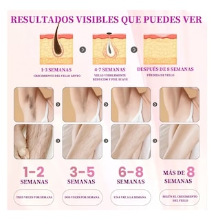 Foto 2 | Foto 2 | Depiladora Belug Láser Ipl Permanente sin Dolor para Cuerpo y Cara Blanca