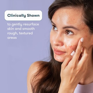Foto 2 | Foto 2 | Gel Facial Para Tratamiento De Cicatrices De Acné Proactiv - Venta Internacional.