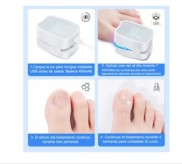 Foto 3 | Foto 3 | Tratamiento Láser De Hongos En Las Uñas Y Onicomicosis