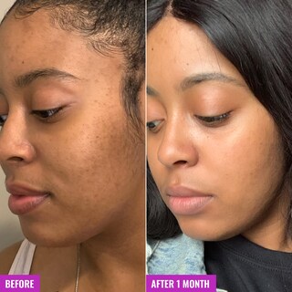 Foto 5 | Foto 5 | Tónico Facial Good Molecules Exfoliante Glicólico 120 Ml - Venta Internacional.