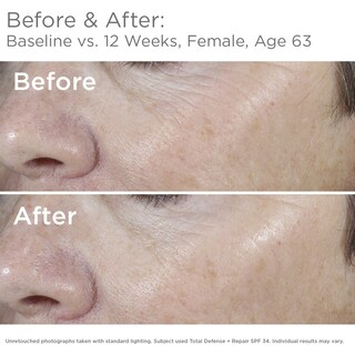 Foto 2 | Foto 2 | Protector Solar Skinmedica Total Defense + Repair Spf 34 68 Ml - Venta Internacional.