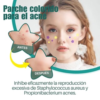 Foto 4 | Foto 4 | 112 Star-parches Invisibles Eliminar Acne Estrella Granos