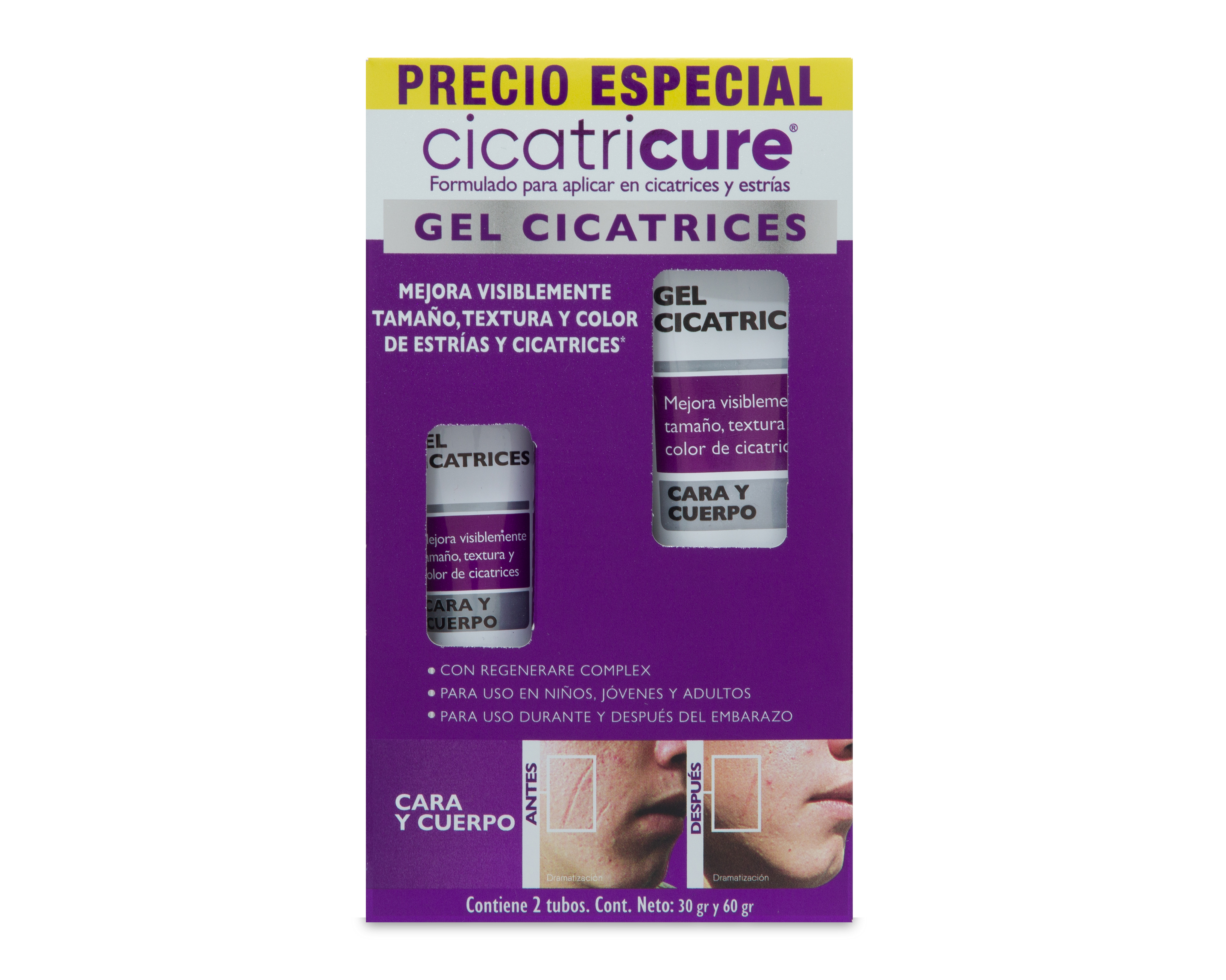 Foto 6 pulgar | Foto 5 | Gel para Cicatrices Cicatricure Cara y Cuerpo 2 Piezas